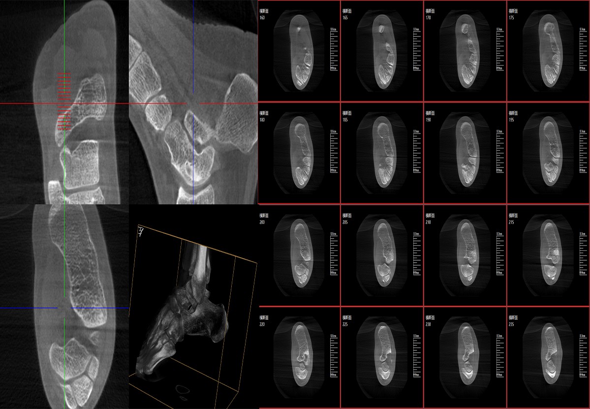 Why choose 3D x-ray imaging system？