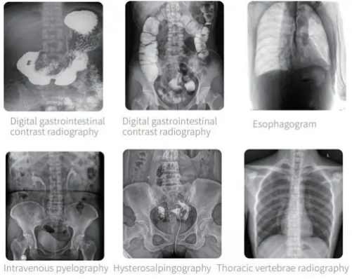 PLX8500 Series Multifunctional Dynamic Digital radiography