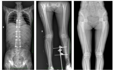 What kind of equipment do hospitals use to take pictures?What is the difference between DR, CT and MRI?