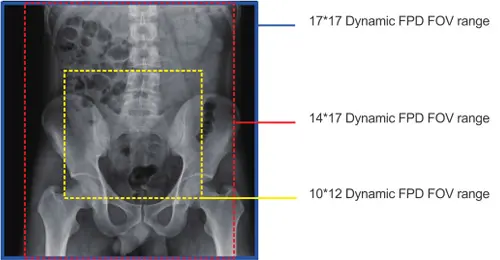 Compared with common X-ray machine, what will you get from using DRF?
