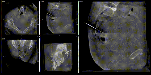 8.gif