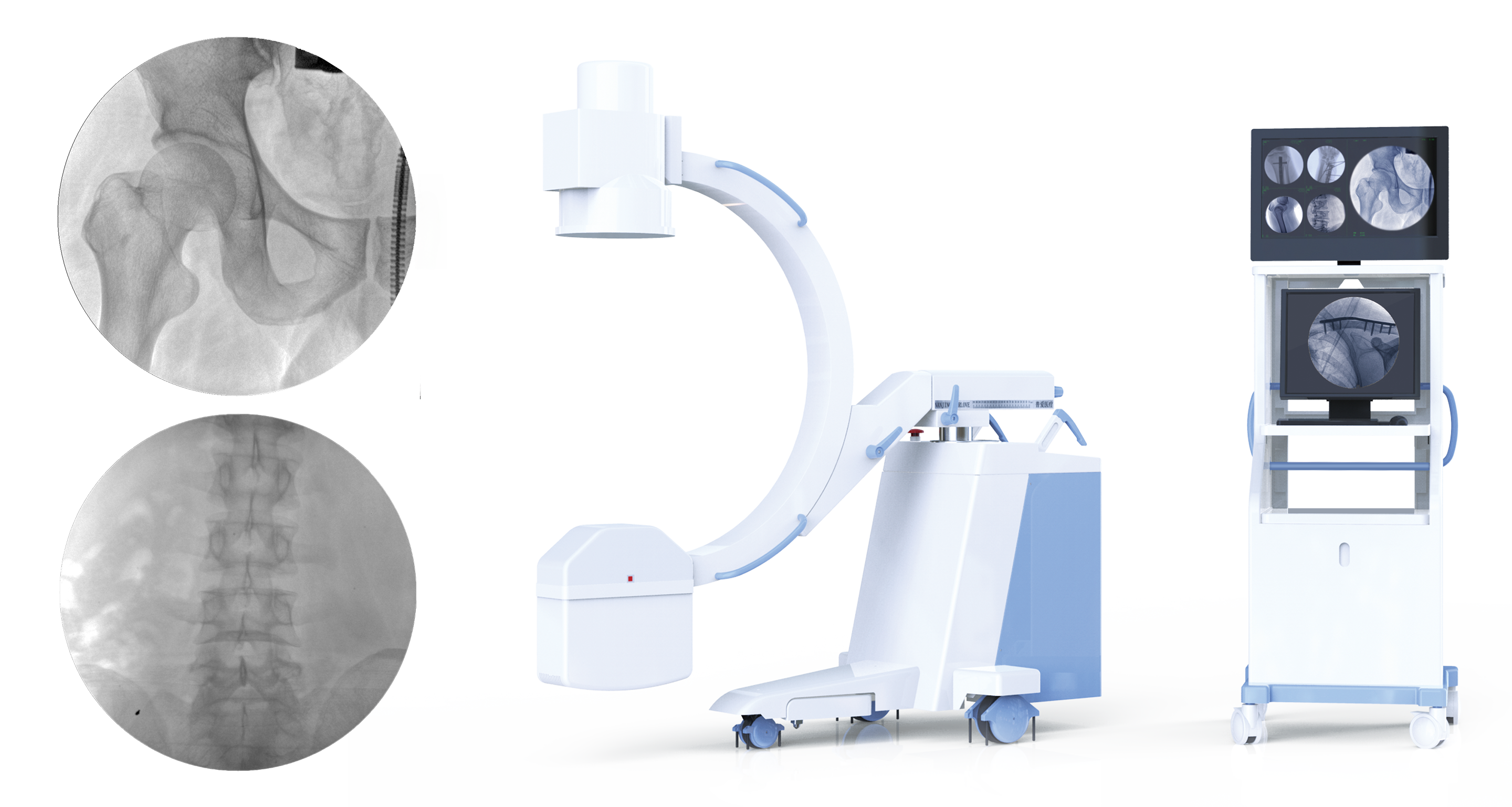 Four Generations of C-arm in a Decade — Full Installed at Qiqihar Hospital of Traditional Chinese Medicine 