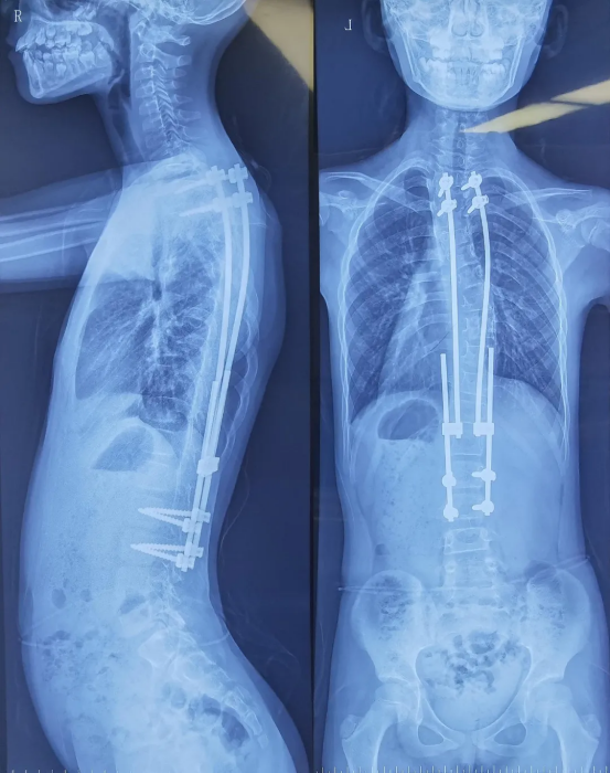 302aab8bf014a6c3fd6760684fb03f63.png 302aab8bf014a6c3fd6760684fb03f63.png