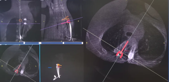 f764f0b6975e0e464b0856963ae5d0c9.png f764f0b6975e0e464b0856963ae5d0c9.png